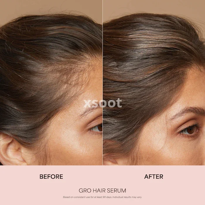 Buy GRO Hair Serum & Shampoo/Conditioner Gift Set Online